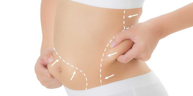 Non-Surgical Procedures For Fat Reduction