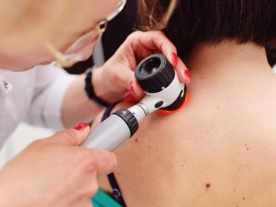 Skin Cancer Clinic Melbourne