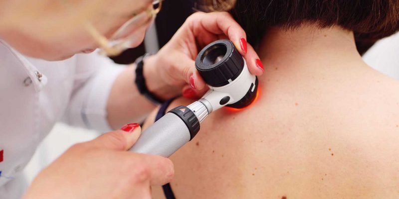 Skin Cancer Clinic Melbourne